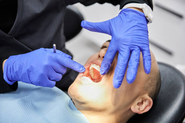 Best Broken or Cracked Tooth Emergency Dentist in Ridge, NY
